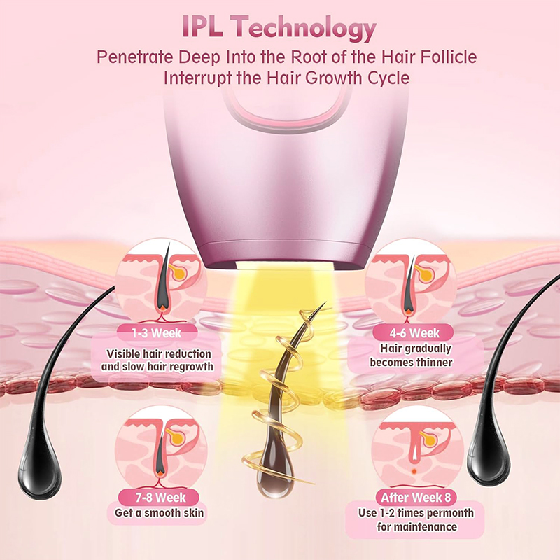 IPL лазерная эпиляция, машина  – обзор и цена Hair Care Or Haircare