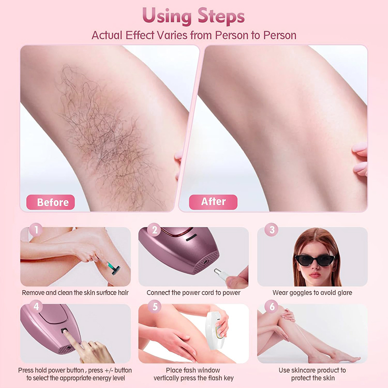 IPL лазерная эпиляция, машина  – обзор и цена Hair Care Or Haircare